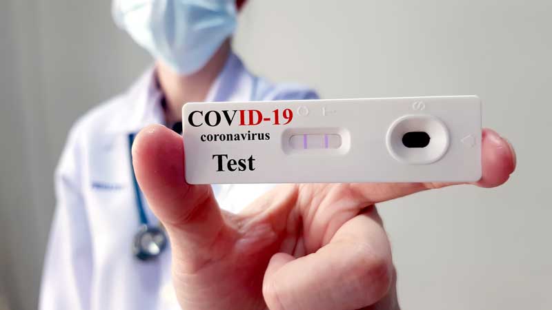 TESTAGEM-PARA-COVID