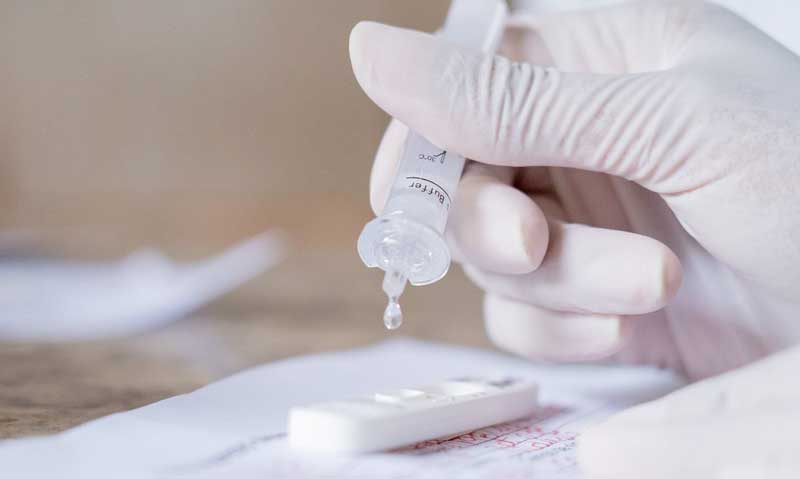 teste-rápido-coronavirus