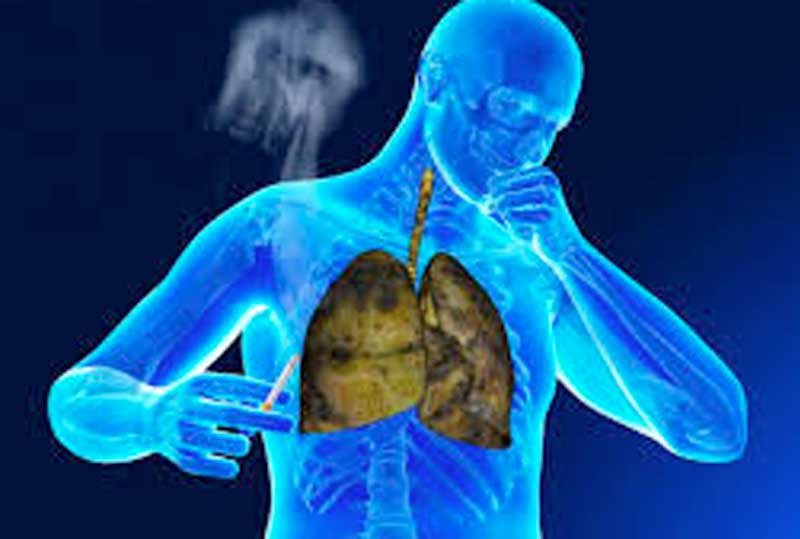 tuberculose.jpg