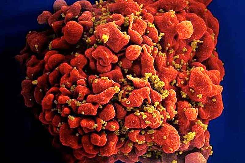 Cientistas-revelam-novo-caso-de-remissão-do-HIV