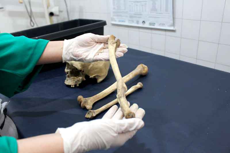 Peritos-do-Amazonas-usam-antropologia-forense-para-identificar-ossadas-humanas