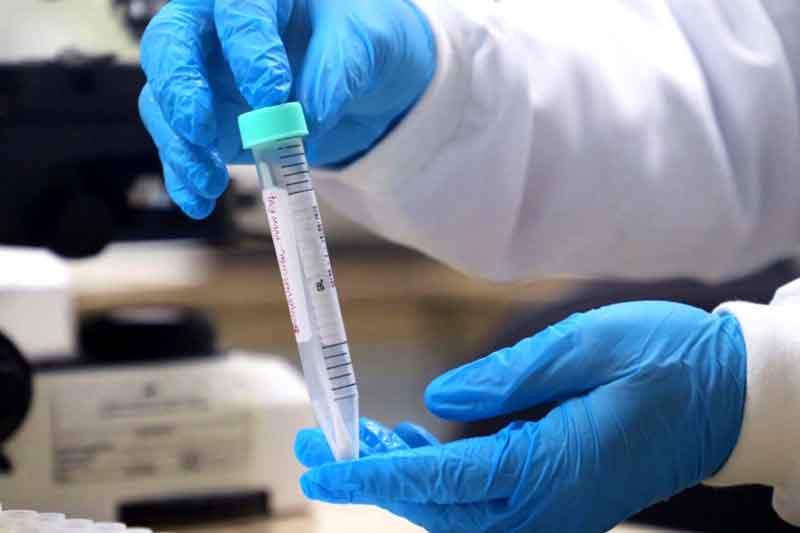 Mpox-Saúde-do-Amazonas-enfatiza-o-estado-estável-e-intensifica-as-medidas-de-prevenção