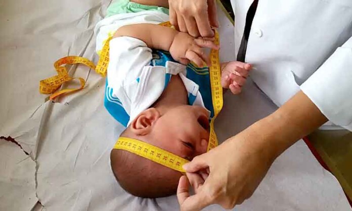 INSS-pagará-indenização-de-R$-60-mil-a-crianças-vítimas-de-zika-vírus