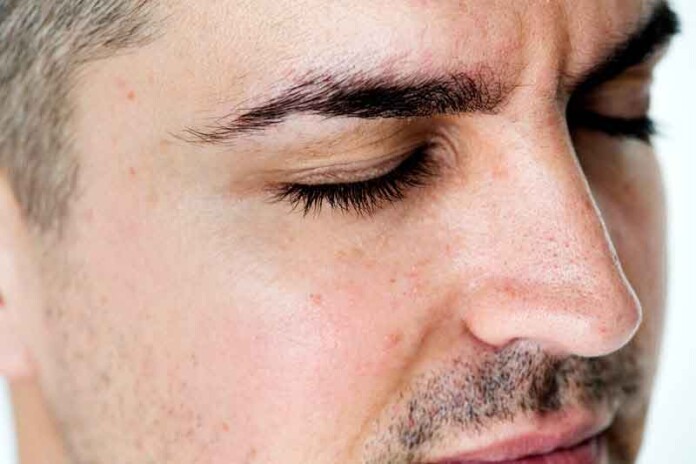 Entenda-por-que-pode-ser-perigoso-cortar-os-cílios