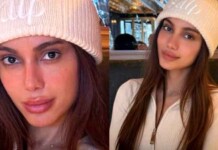 Anitta muda mais uma vez e público já não reconhece o rosto original