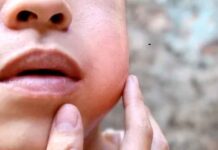 Dor de dente deixa de ser simples incômodo e passa a afetar trabalho e qualidade de vida