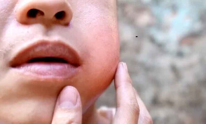 Dor-de-dente-deixa-de-ser-simples-incômodo-e-passa-a-afetar-trabalho-e-qualidade-de-vida