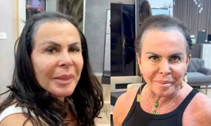 Gretchen-desabafou-ao-falar-de-sua-luta-contra-a-alopecia
