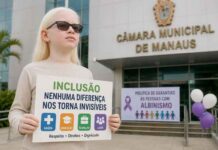 Nova lei fortalece a inclusão das pessoas com albinismo em Manaus e amplia garantias de direitos